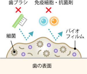 船堀(東京都江戸川区)の歯医者、ライフケアデンタルオフィスでバイオフィルムと歯垢の違いについての解説