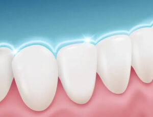 船堀（東京都江戸川区）の歯医者、ライフケアデンタルオフィスで歯の表面がザラザラする原因と滑らかにする方法を解説